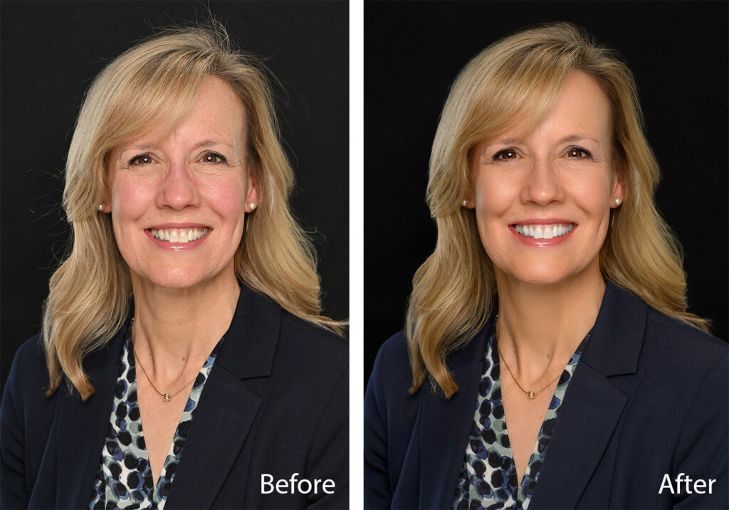 Before and after professional retouching of a corporate headshot.